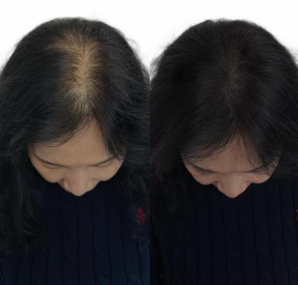 [울산 신정동] 오소울산