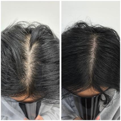 [춘천 요선동] 더 제이스칼프