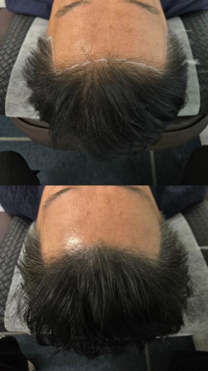 [안양 호계동] 인더스칼프