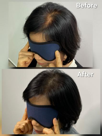 [경산 중산동] 두피행복SMP