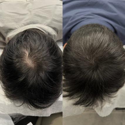 [광주 장덕동] 그레이시티 광주직영점