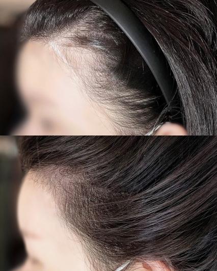 [용산구 이태원 / 한남] 뷰티 러스