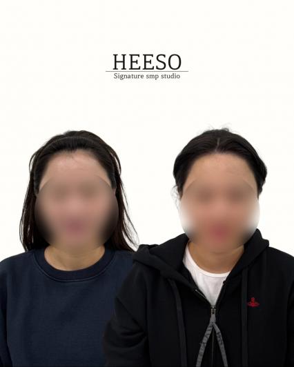 [인천 가정역] 희소SMP