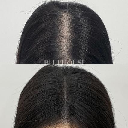 [송파구 가락동] 블루하우스 서울