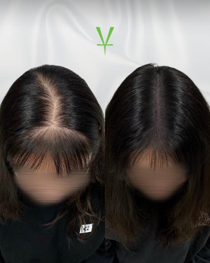 [강동구 성내동] 비타SMP