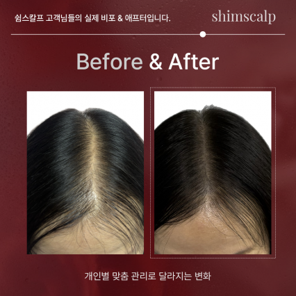 [수원 인계동] 쉼스칼프(SHIMSCALP)