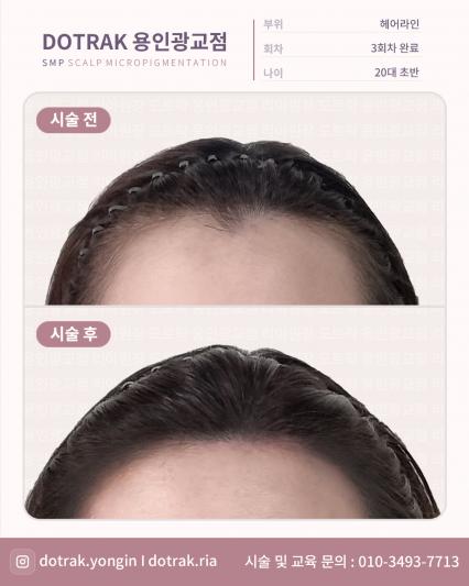 [상현역] 도트락 용인 광교점