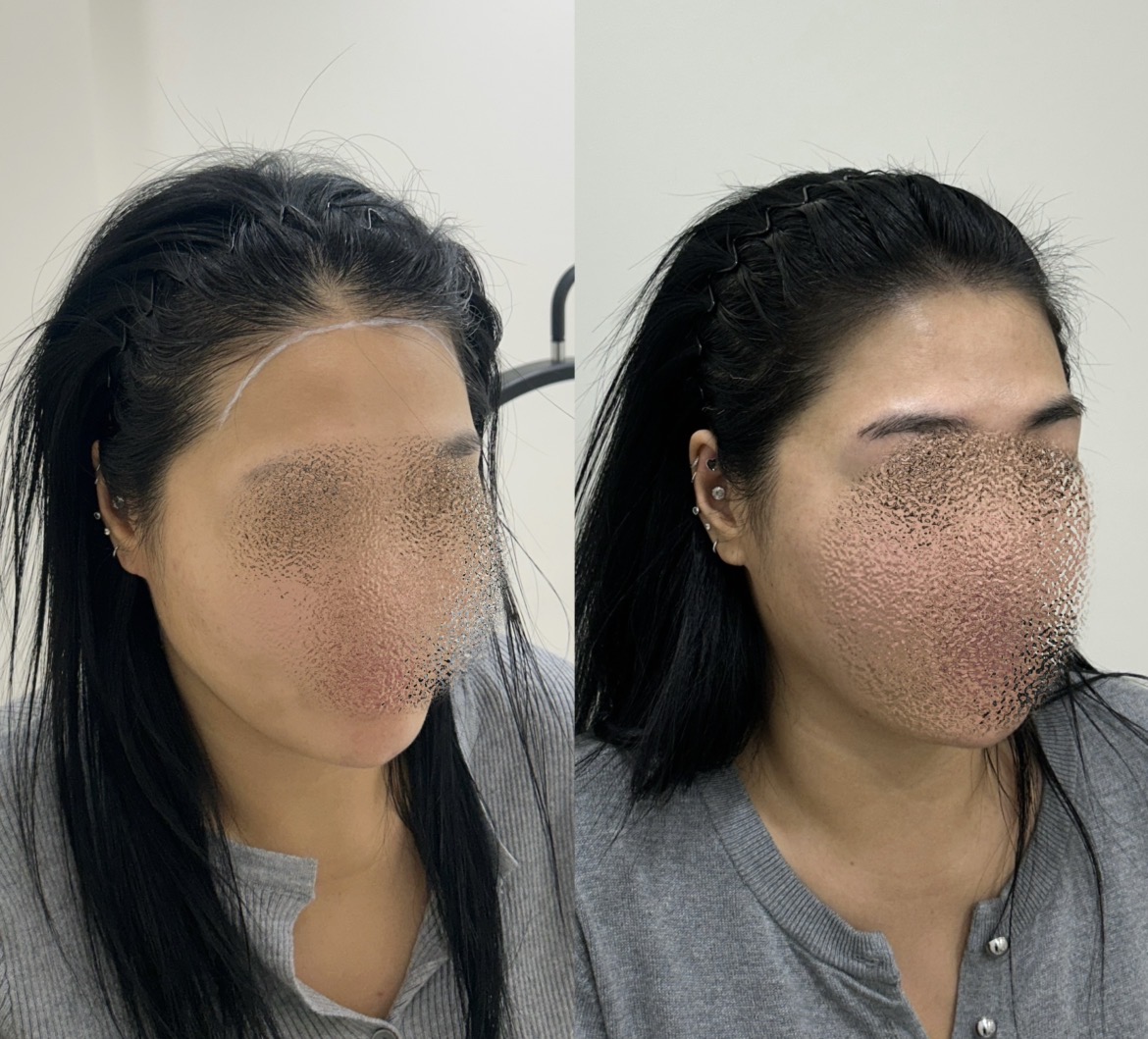 [강남역] 댓스칼프