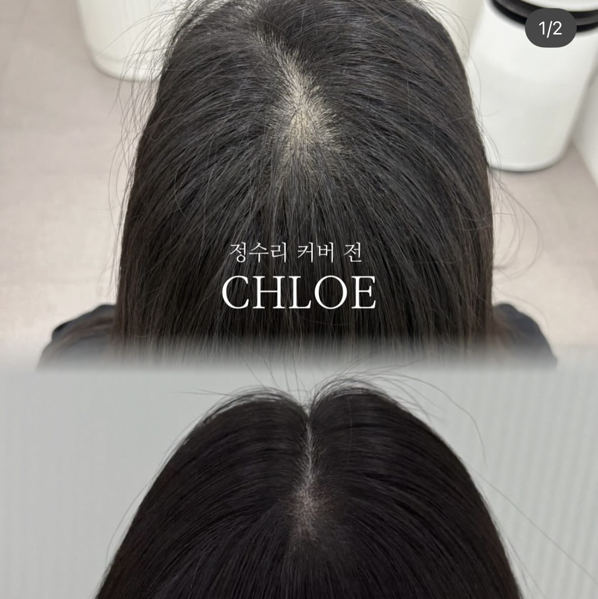 [대구] 대구 클로이스칼프smp