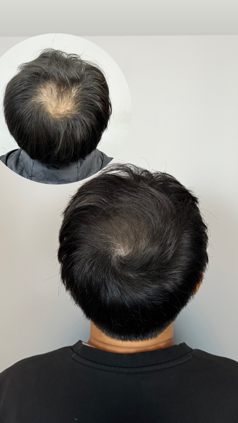 [안양 범계역] 비닷