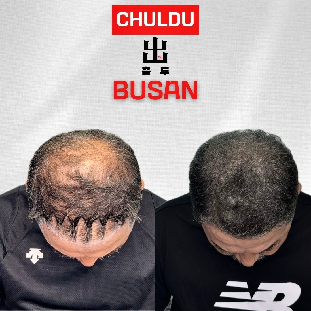 [부산 서면역] 감각SMP 부산본점