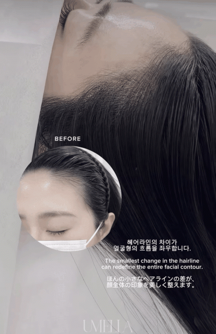 유멜라뷰티