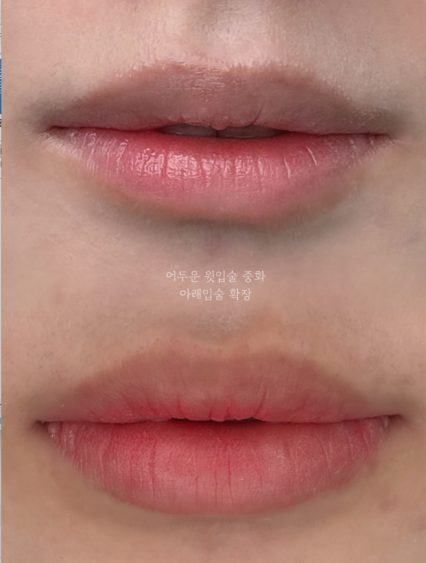 새벽의달