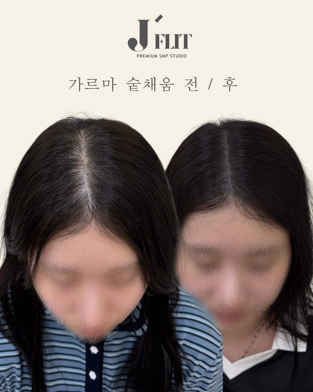 제이플릿smp